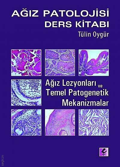 Ağız Patolojisi Ders Kitabı Prof. Dr. Tülin Oygür  - Kitap
