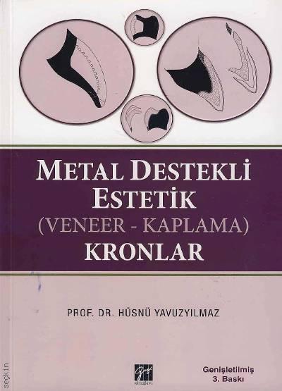 Metal Destekli Estetik (Veneer–Kaplama) Kronlar Prof. Dr. Hüsnü Yavuzyılmaz  - Kitap